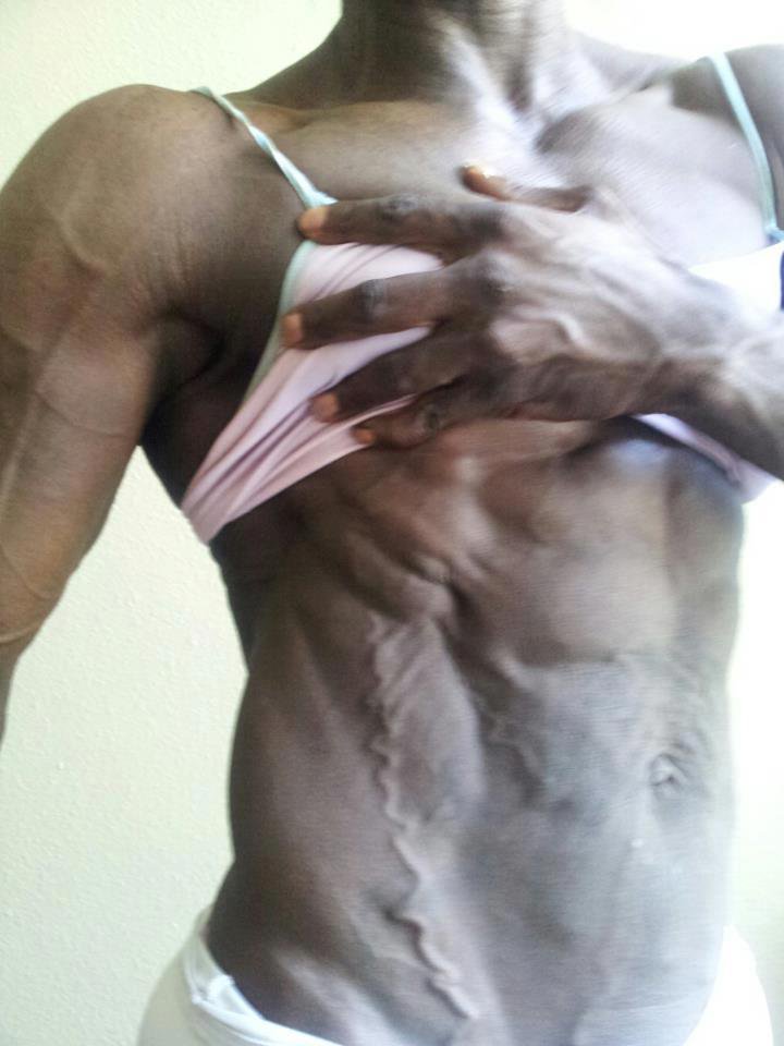 Billede